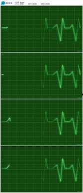 吃瓜心电图视频,揭秘瓜界“心跳”的秘密